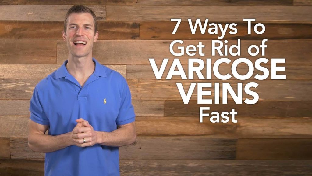 7 Safe and Effective Ways to Eliminate Varicose Veins Quickly 7 Safe and Effective Ways to Eliminate Varicose Veins Quickly