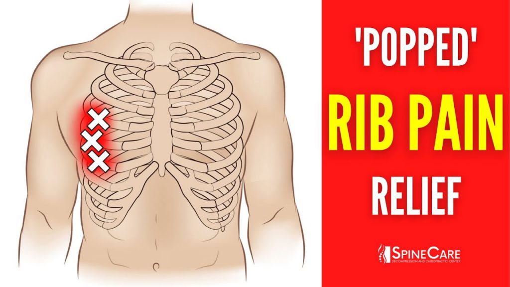 “Relieving Discomfort: A Simple Guide on Fixing a Misaligned Rib”