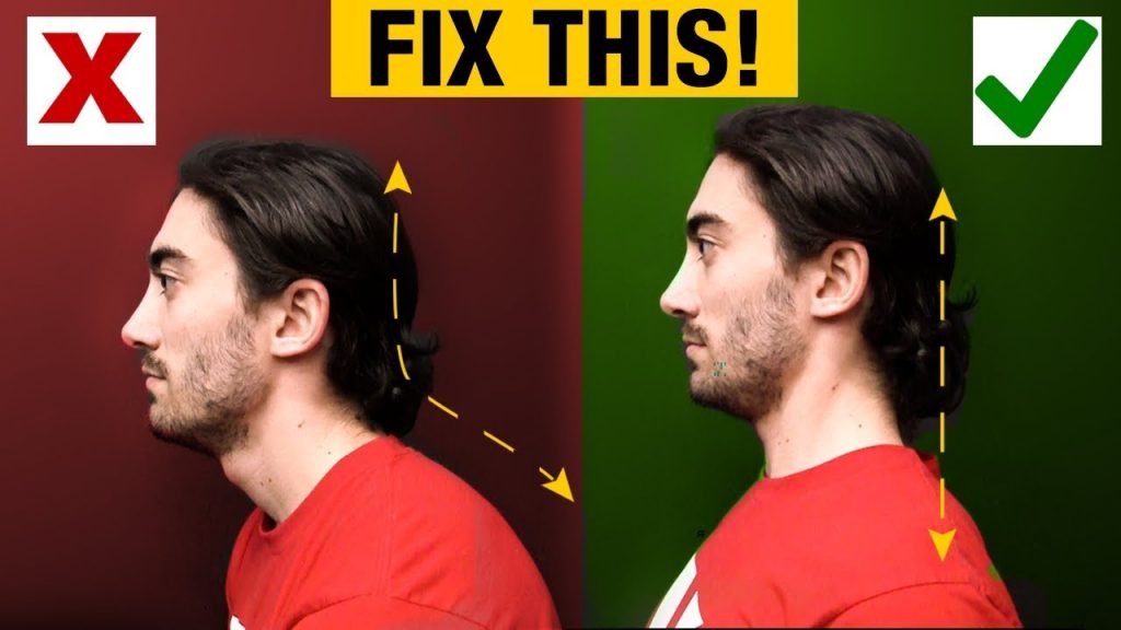 Fix Forward Head and Slumped Posture Permanently: A Comprehensive Guide Fix Forward Head and Slumped Posture Permanently: A Comprehensive Guide