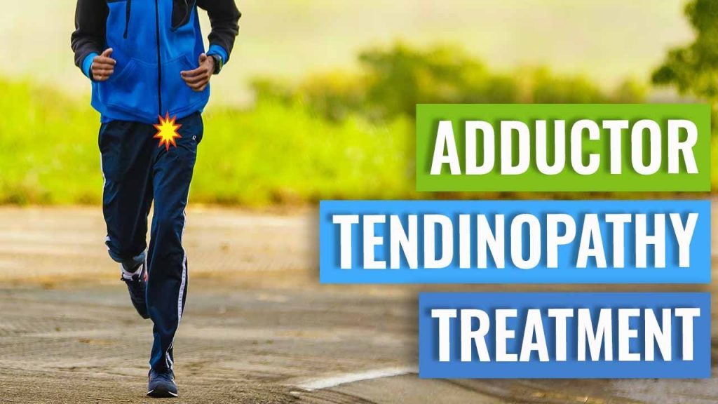 “Effective Strategies for Treating Adductor Tendinopathy: Tips from Medical Experts” “Effective Strategies for Treating Adductor Tendinopathy: Tips from Medical Experts”
