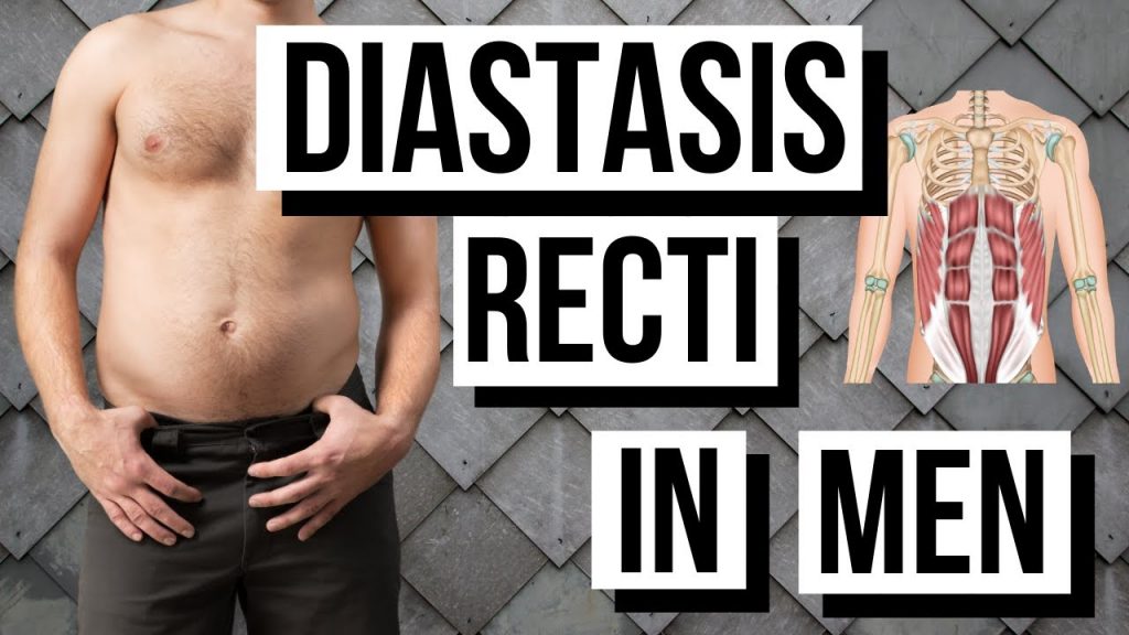 “Get Rid of Your Belly Bulge: Diastasis Recti Solutions for Men Over 35” “Get Rid of Your Belly Bulge: Diastasis Recti Solutions for Men Over 35”